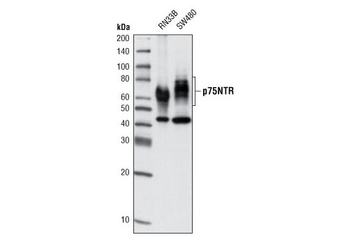 Western blot analysis of extracts from RN33B and SW480 cells using p75NTR (D8A8) Rabbit mAb.