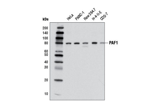 Western blot analysis of extracts from various cell lines using PAF1 (D9G9X) Rabbit mAb.
