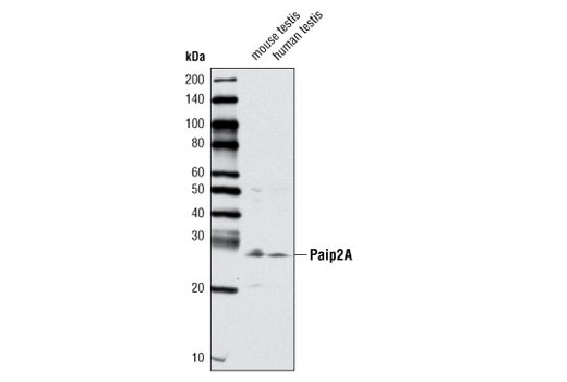 Western blot analysis of extracts from mouse testis and human testis using Paip2A Antibody.
