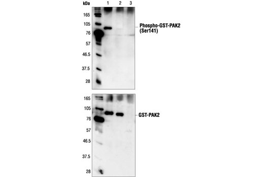 Western blot analysis of extracts from COS cells cotransfected with activated cdc42 and GST-PAK2 (lane 1), transfected with GST-PAK2 alone (lane 2) or activated cdc42 alone (lane 3), using Phospho-PAK1 (Ser144)/PAK2 (Ser141) Antibody (upper) or PAK1/2/3 Antibody #2604 (lower). This antibody detects GST-PAK2 signal only when it is cotransfected with activated cdc42, indicating that this antibody is phospho-specific.