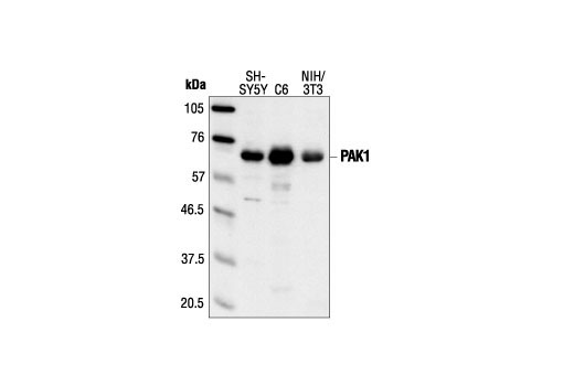 Western blot analysis of extracts from SH-SY5Y, C6 and NIH/3T3 cells, using PAK1 Antibody.
