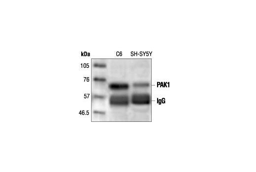 Immunoprecipitation of PAK1 from C6 and SH-SY5Y cells followed by Western blot analysis, using PAK1 Antibody.