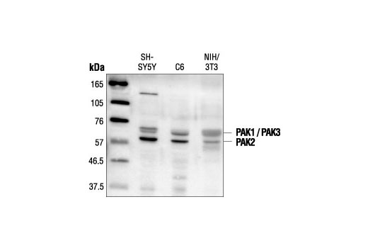Western blot analysis of extracts from SH-SY5Y, C6 and NIH/3T3 cells, using PAK1/2/3 Antibody.