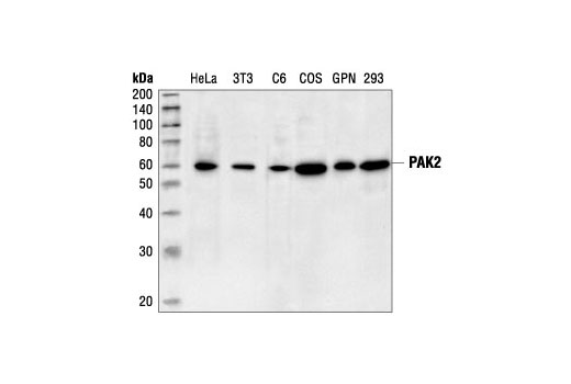 Western blot analysis of extracts from HeLa, NIH/3T3, C6, COS, guinea pig neutrophils (GPN) and HEK293 cells, using PAK2 Antibody.