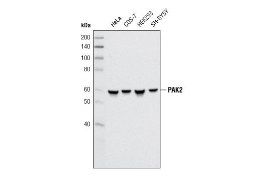Western blot analysis of extracts from various cell types using PAK2 (3B5) Mouse mAb.