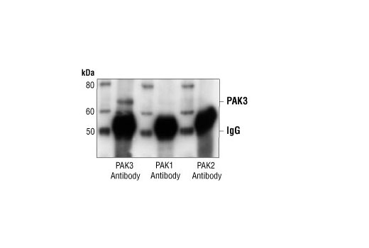 Immunoprecipitation of PAK3 from mouse brain extract, using PAK3 Antibody, followed by Western blot analysis using PAK3 Antibody (left), PAK1 Antibody #2602 (middle) or PAK2 Antibody #2608 (right).