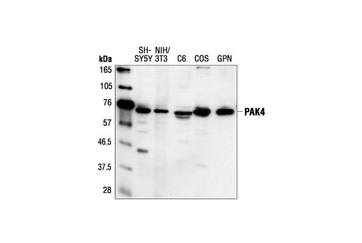 Western blot analysis of extracts from SH-SY5Y, NIH/3T3, C6 and COS cells and guinea pig neutrophils, using PAK4 Antibody.