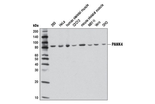 Western blot analysis of extracts from various cell lines and tissues using PANK4 (D8N2C) Rabbit mAb.