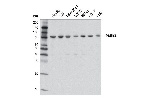 Western blot analysis of extracts from various cell lines using PANK4 (D6J4R) Rabbit mAb.