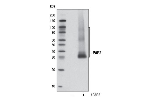 Western blot analysis of extracts from COS-7 cells, untransfected (-) or transfected with human PAR2 (+), using PAR2 (D61D5) Rabbit mAb.