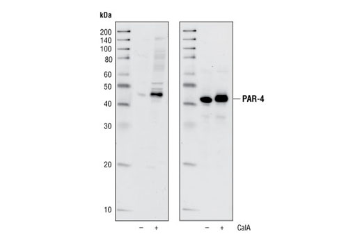 Western blot analysis of extracts from HeLa cells, untreated or treated with Calyculin A (100 nM, 5 minutes), using Phospho-PAR-4 (Thr163) Antibody (upper) or total PAR-4 Antibody #2328 (lower).