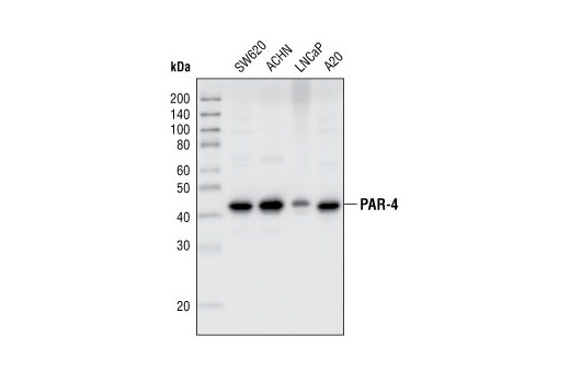 Western blot analysis of extracts from SW620, ACHN, LNCaP and A20 cell lines, using PAR-4 Antibody.