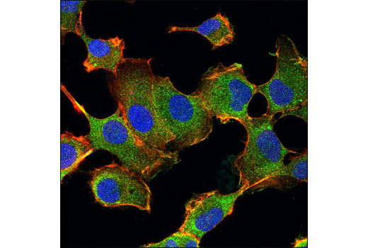 Confocal immunofluorescent analysis of HT-1080 cells using PAR-4 Antibody (green). Actin filaments were labeled with DY-554 phalloidin (red). Blue pseudocolor = DRAQ ® #4084 (fluorescent DNA dye).