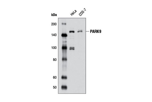 Western blot analysis of extracts from HeLa and COS-7 cells using PARK9 Antibody.