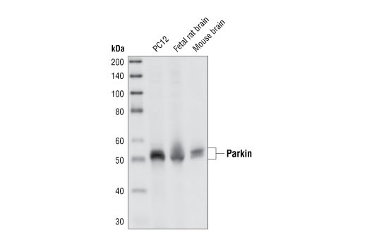 Western blot analysis of extracts from PC12 cells, fetal rat brain and mouse brain, using Parkin (Prk8) Mouse mAb.