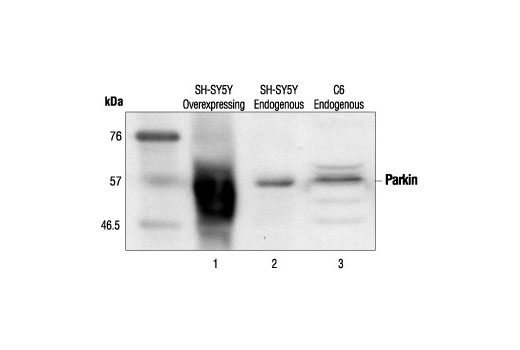 Western blot analysis of extracts from parkin-transfected SH-SY5Y cells (lane 1), untransfected SH-SY5Y cells (lane 2) and C6 cells (lane 3), using Parkin Antibody.