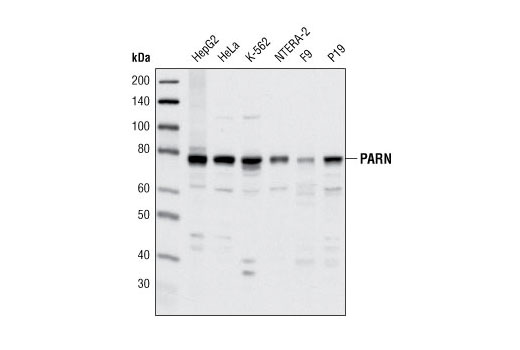 Western blot analysis of extracts from various cell lines using PARN (A42) Antibody.