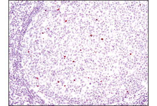 Immunohistochemical analysis of paraffin-embedded human tonsil using Cleaved PARP (Asp214) (D64E10) XP ® Rabbit mAb.