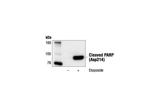 Western blot analysis of extracts from Jurkat cells, untreated or etoposide-treated (25 µM, 5hrs), using Cleaved PARP (Asp214) (19F4) Mouse mAb (Human Specific).