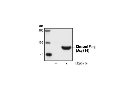 Western blot analysis of Jurkat cells, untreated or etoposide-treated (25 µM, 5hrs), using Cleaved PARP (Asp214) Antibody (Human Specific).