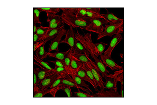Confocal immunofluorescent analysis of untreated HeLa cells labeled with PARP (46D11) Rabbit mAb (green). Actin filaments have been labeled with Alexa Fluor® 555 phalloidin (red).