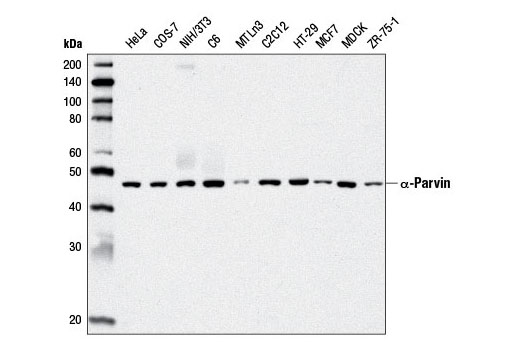 Western blot analysis of extracts from various cell lines using α-Parvin (D7F9) XP ® Rabbit mAb.