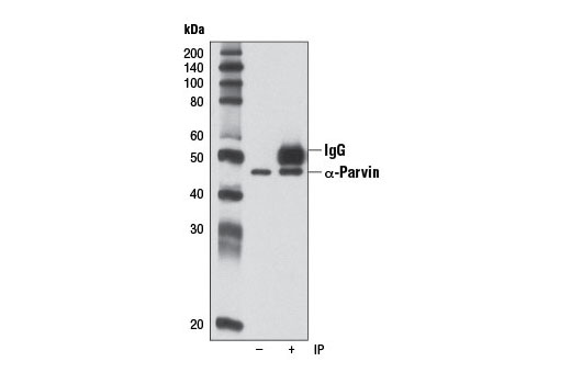 Immunoprecipitation of α-Parvin from HeLa cells using α-Parvin (D7F9) XP ® Rabbit mAb. Western blot was performed using the same antibody. Lane 1 is 10% input (-).