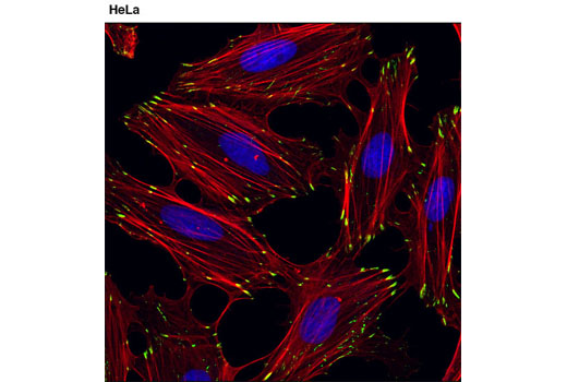 Confocal immunofluorescent analysis of HeLa cells using α-Parvin (D7F9) XP ® Rabbit mAb (green). Actin filaments were labeled with DY-554 phalloidin (red). Blue pseudocolor= DRAQ5 ® #4084 (fluorescent DNA dye).