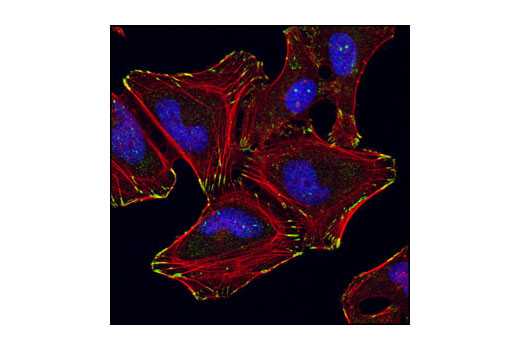 Confocal immunofluorescent analysis of HeLa cells using α-Parvin Antibody (green). Actin filaments have been labeled with DY-554 phalloidin (red). Blue pseudocolor = DRAQ5 ® #4084 (fluorescent DNA dye).
