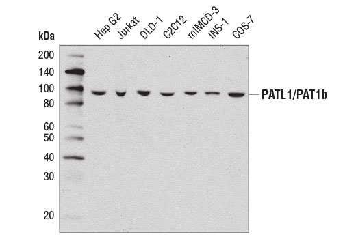 Western blot analysis of extracts from various cell lines using PATL1/PAT1b (D8P1B) Rabbit mAb.