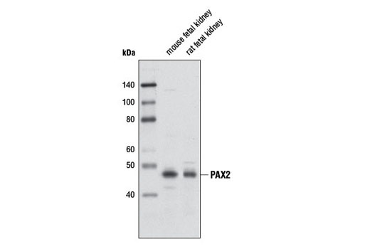 Western blot analysis of extracts from mouse and rat fetal kidney tissues using PAX2 Antibody.