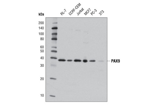 Western blot analysis of extracts from various cell lines using PAX9 (D9F1N) Rabbit mAb.