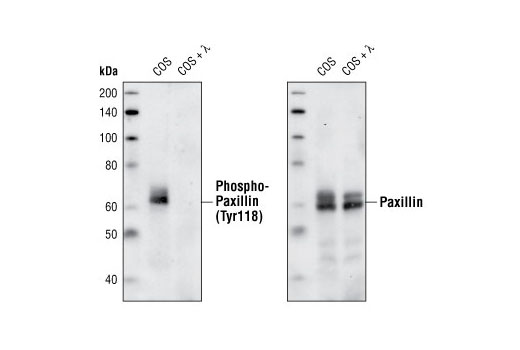 Western blot analysis of untreated and lambda-phosphatase treated COS cells, using Phospho-Paxillin (Tyr118) Antibody (left) and Paxillin Antibody #2542 (right).