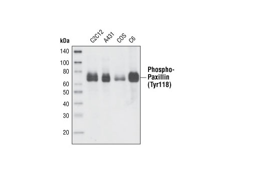 Western blot analysis of extracts from various cell lines using Phospho-Paxillin (Tyr118) Antibody.