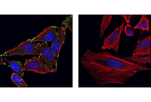 Confocal immunofluorescent analysis of Hela cells -/+ lamda phosphatse labeled with Phospho-Paxillin (Tyr118) Antibody (green). Note the robust signal in the untreated cells (left) versus the lambda phosphatse treated cells (right).