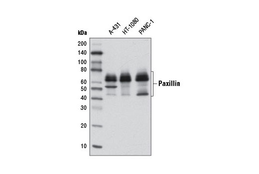 Western blot analysis of extracts from various cell lines using Paxillin (D9G12) Rabbit mAb. The 45 kDa band is a degradation product of full-length paxillin protein.