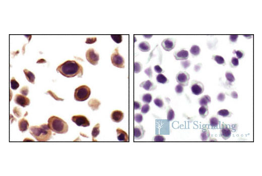Immunohistochemical analysis of paraffin-embedded ME-180 cells, using PBK/TOPK Antibody (left), or no primary antibody (right).