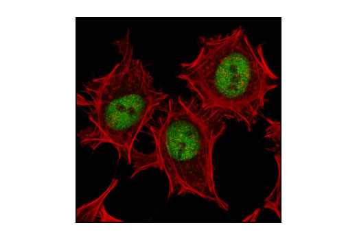 Confocal immunofluorescent analysis of HeLa cells using Pbx1 Antibody (green). Actin filaments have been labeled with DY-554 phalloidin (red).