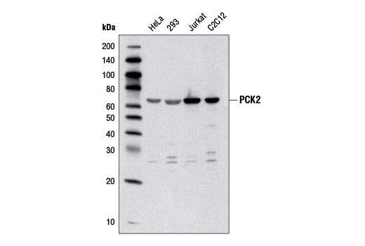 Western blot analysis of extracts from various cell lines using PCK2 Antibody.