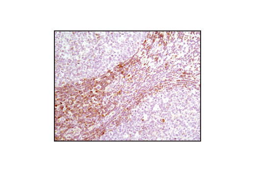 Immunohistochemical analysis of paraffin-embedded human tonsil using PDCD4 (D29C6) XP ® Rabbit mAb.