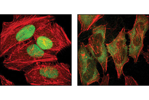 Confocal immunofluorescent analysis of HeLa cells, untreated (left) or serum-starved (right), using PDCD4 (D29C6) XP ® Rabbit mAb (green). Actin filaments have been labeled with DY-554 phalloidin (red).