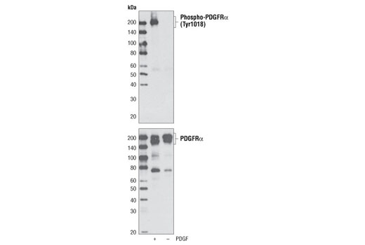 Western blot analysis of cell extracts from NIH/3T3 cells, untreated or treated with PDGF-AA, using Phospho-PDGF Receptor α (Tyr1018) Antibody (upper) or PDGF Receptor α Antibody #3164 (lower).