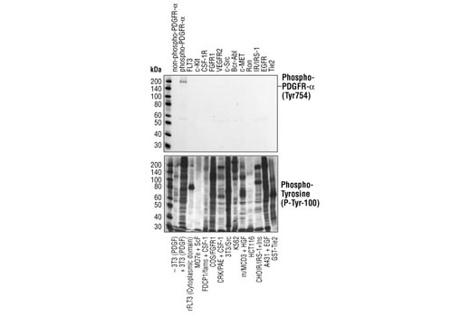 Phospho-PDGF Receptor α (Tyr754) (23B2) Rabbit mAb specifically binds to tyrosine phosphorylated PDGF receptor α, but not other phosphorylated tyrosine kinases. Western blot analysis of of extracts from cells expressing different activated tyrosine kinase proteins, using Phospho-PDGF Receptor α (Tyr754) (23B2) Rabbit mAb (upper) or Phospho-Tyrosine Mouse mAb (P-Tyr-100) #9411 (lower).