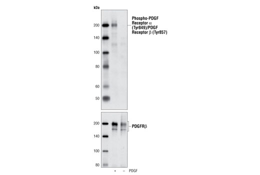 Western blot analysis of NIH/3T3 cells, untreated or treated with PDGFbb using Phospho-PDGF Receptor α (Tyr849)/PDGF Receptor β (Tyr857) (C43E9) Rabbit mAb (upper) and PDGF Receptor β (28E1) Rabbit mAb #3169 (lower).