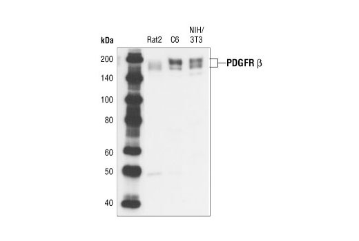 Western blot analysis of extracts from various cell lines, using PDGF Receptor β (28E1) Rabbit mAb.