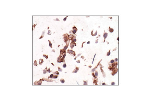 Immunohistochemical analysis of paraffin-embedded U-87MG cells, showing membrane localization, using PDGF Receptor β (28E1) Rabbit mAb.
