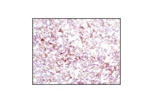 Immunohistochemical analysis of frozen U-87MG xenograft using PDGF Receptor beta (28E1) Rabbit mAb.