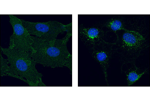 Confocal immunofluorescent analysis of NIH/3T3 cells, serum-starved (left) or PDGF-treated (right), using PDGF Receptor beta (28E1) Rabbit mAb (green). Blue pseudocolor = DRAQ5 ® #4084 (fluorescent DNA dye).