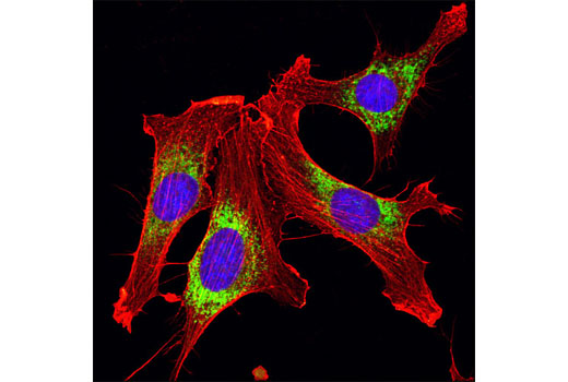 Confocal immunofluorescent analysis of NIH/3T3 cells using PDI Antibody (green) and β-Actin (8H10D10) Mouse mAb #3700 (red). Blue pseudocolor = DRAQ5 ® #4084 (fluorescent DNA dye).