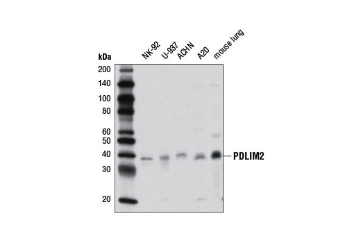 Western blot analysis of extracts from various cell lines and mouse lung using PDLIM2 Antibody.